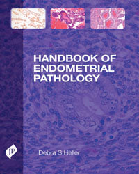 HANDBOOK OF ENDOMETRIAL PATHOLOGY 1/E, 2012, DEBRA S HELLER