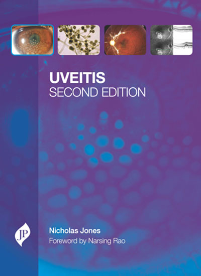 UVEITIS WITH CD-ROM 2/E, 2013, NICHOLAS JONES