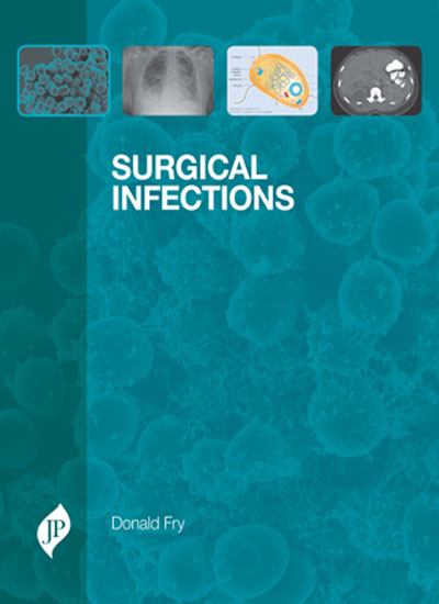 SURGICAL INFECTIONS 1/E, 2013, DONALD E FRY