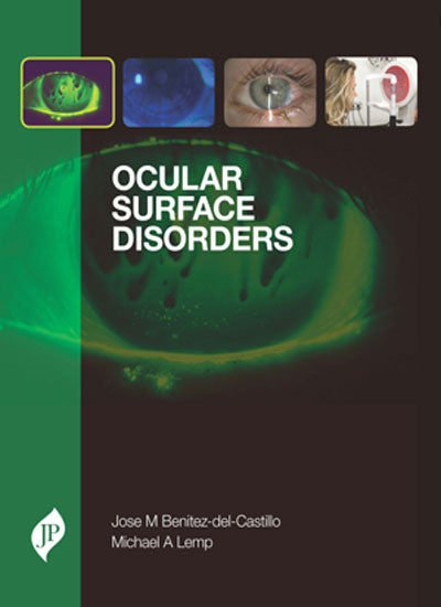 OCULAR SURFACE DISORDERS 1/E, 2014, JOSE M. BENITEZDELCASTILLO