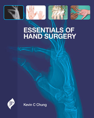 ESSENTIALS OF HAND SURGERY 1/E, 2015, KEVIN C CHUNG