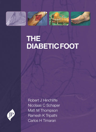 THE DIABETIC FOOT 1/E, 2014, ROBERT J. HINCHLIFFE