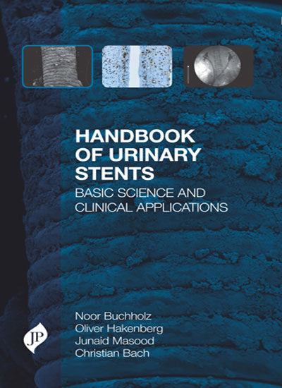 HANDBOOK OF URINARY STENTS BASIC SCIENCE AND CLINICAL APPLICATIONS 1/E, 2016, NOOR BUCHHOLZ