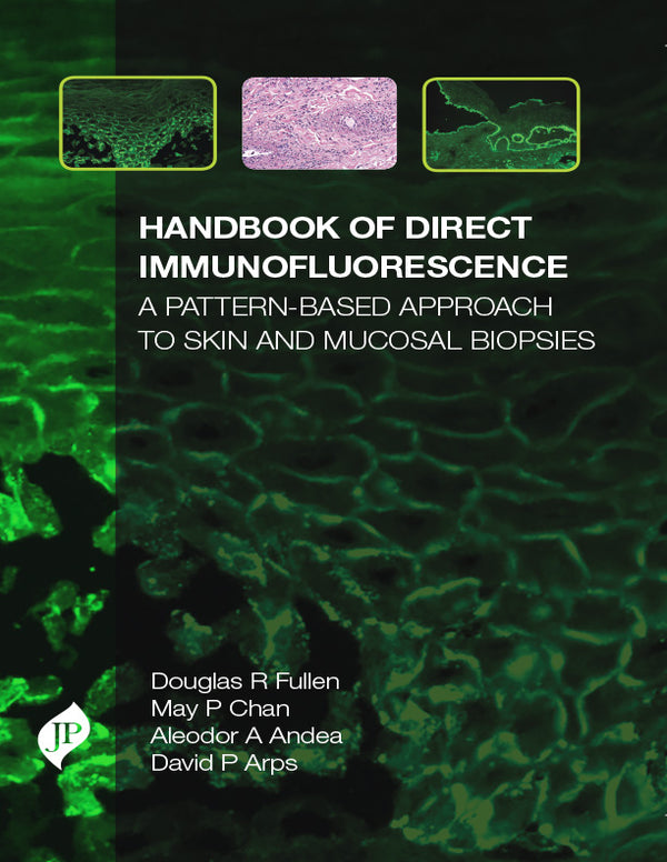 HANDBOOK OF DIRECT IMMUNOFLUORESCENCE: A PATTERN -BASED APPROACH TO SKIN AND MUCOSAL BIOPSIES 1/E, 2018, DOUGLAS FULLEN