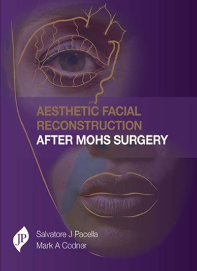 AESTHETIC FACIAL RECONSTRUCTION AFTER MOHS SURGERY 1/E, 2017, SALVATORE J PACELLA