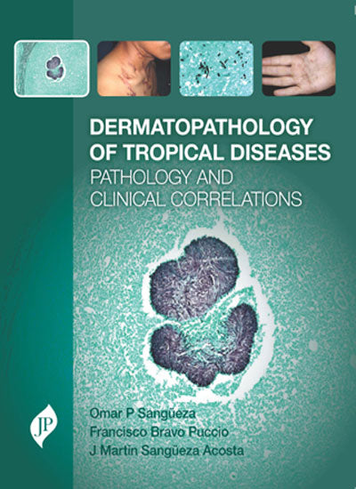 DERMATOPATHOLOGY OF TROPICAL DISEASES PATHOLOGY AND CLINICAL CORRELATIONS 1/E, 2017, OMAR P SANGUEZA
