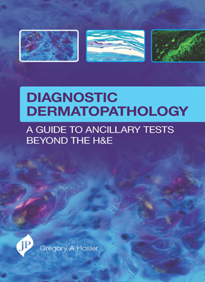 DIAGNOSTIC DERMATOPATHOLOGY:A GUIDE TO ANCILLARY TESTS BEYOND THE H&E 1/E, 2017, GREGORY A HOSLER