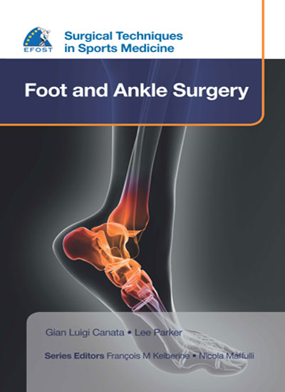 SURGICAL TECHNIQUES IN SPORTS MEDICINE FOOT AND ANKLE SURGERY 1/E, 2016, GLAN LULGI CANATA