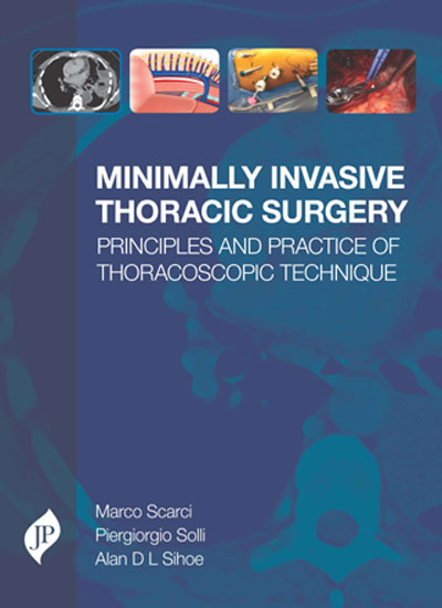 MINIMALLY INVASIVE THORACIC SURGERY PRINCIPLES AND PRACTICE OF THORACOSCOPIC TECHNIQUE 1/E, 2018, MARCO SCARCI