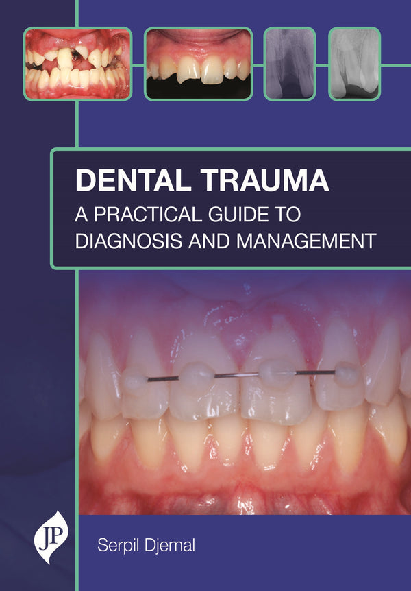 DENTAL TRAUMA: A PRACTICAL GUIDE TO DIAGNOSIS AND MANAGEMENT 1/E, 2021, SERPIL DJEMAL