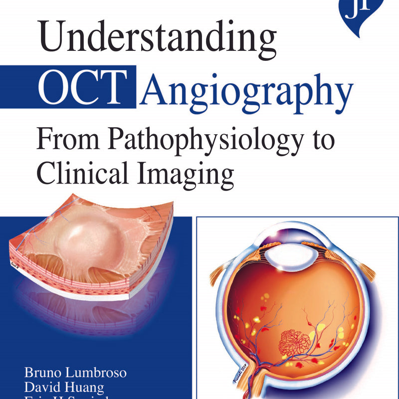 UNDERSTANDING OCT ANGIOGRAPHY FROM PATHOPHYSIOLOGY TO CLINICAL IMAGING 1/E, 2020, BRUNO LUMBROSO