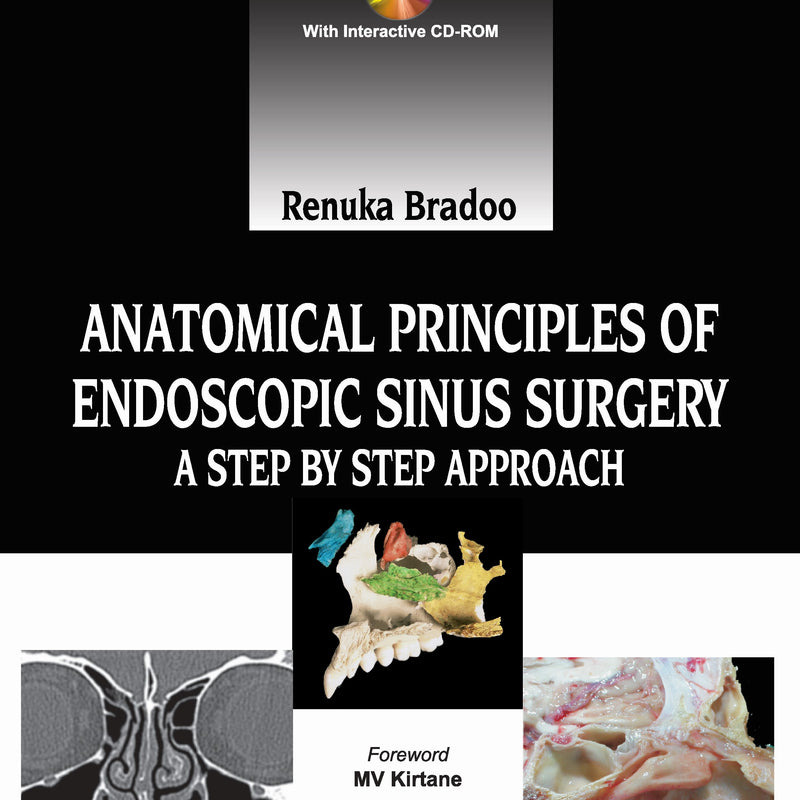 ANATOMICAL PRINCIPLES OF ENDOSCOPIC SINUS SURGERY: A STEP BY STEP APPROACH WITH INTERACTIVE CD-ROM 1/E R.P., 2012, RENUKA BRADOO