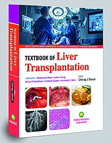 Chirag Desai—Textbook of Liver Transplantation1Ed 2023