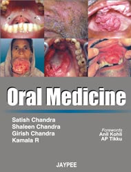 ORAL MEDICINE 1/E, 2007, SATISH CHANDRA