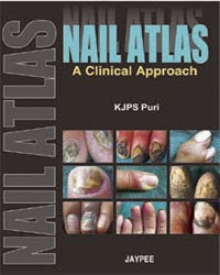 NAIL ATLAS A CLINICAL APPROACH 1/E, 2008, PURI