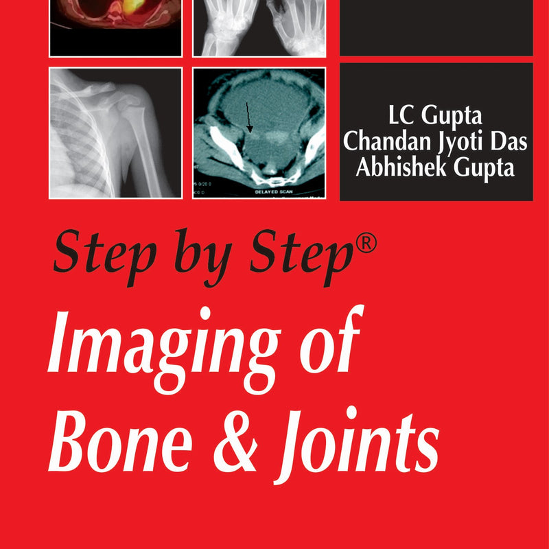 STEP BY STEP IMAGING OF BONE & JOINTS WITH PHOTO CD-ROM 1/E, 2008, LC GUPTA