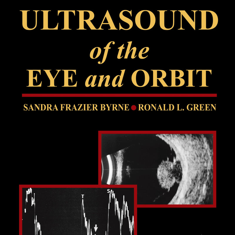 ULTRASOUND OF THE EYE AND ORBIT 2/E, 2010, SANDRA FRAZIER BYRNE