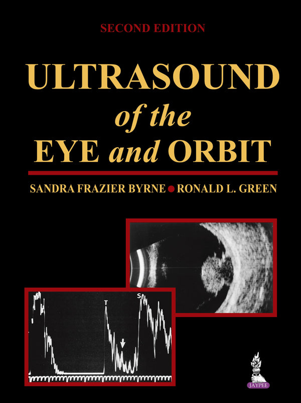 ULTRASOUND OF THE EYE AND ORBIT 2/E, 2010, SANDRA FRAZIER BYRNE