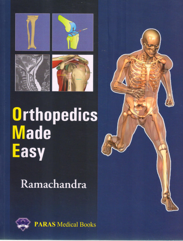 Orthopedics Made Easy 1st/e by Ramachandra