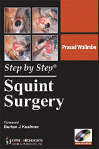 STEP BY STEP SQUINT SURGERY 1/E, 2011, PRASAD WALIMBE