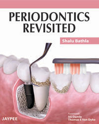 PERIODONTICS REVISITED 1/E, 2011, SHALU BATHLA