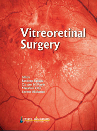 VITREORETINAL SURGERY 1/E, 2012, SANDEEP SAXENA