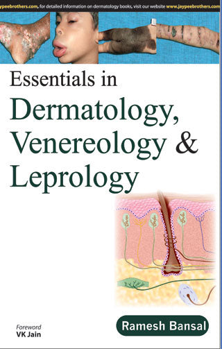 ESSENTIALS IN DERMATOLOGY,VENEREOLOGY & LEPROLOGY 1/E, 2015, RAMESH BANSAL