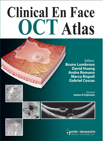 CLINICAL EN FACE OCT ATLAS 1/E, 2013, BRUNO LUMBROSO