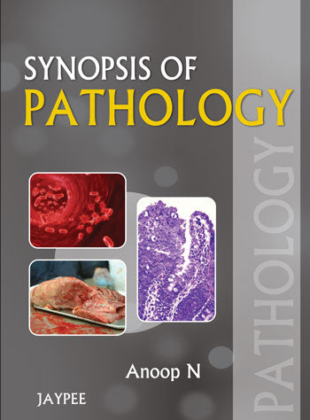 SYNOPSIS OF PATHOLOGY 1/E, 2013, ANOOP