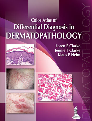 COLOR ATLAS OF DIFFERENTIAL DIAGNOSIS IN DERMATOPATHOLOGY 1/E, 2014, LOREN E CLARKE