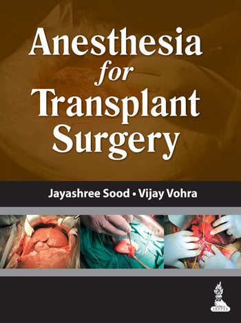 ANESTHESIA FOR TRANSPLANT SURGERY 1/E, 2014, JAYASHREE SOOD