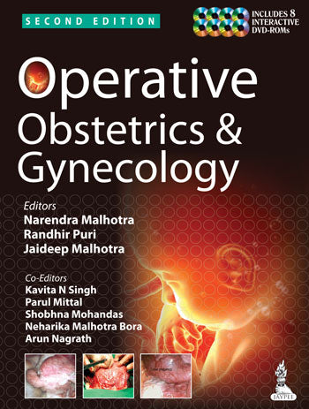 OPERATIVE OBSTETRICS & GYNECOLOGY INCLUDES 8 DVD-ROMS 2/E, 2014, NARENDRA MALHOTRA