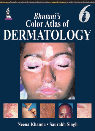 BHUTANI'S COLOR ATLAS OF DERMATOLOGY 6/E, 2015, NEENA KHANNA