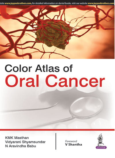 COLOR ATLAS OF ORAL CANCER 1/E, 2016, KMK MASTHAN