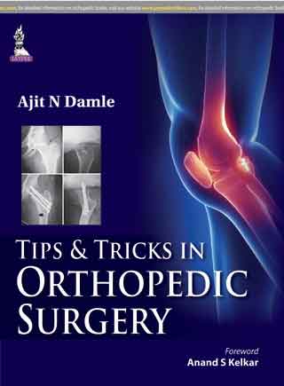 TIP & TRICKS IN ORTHOPEDIC SURGERY 1/E, 2015, AJIT N DAMLE