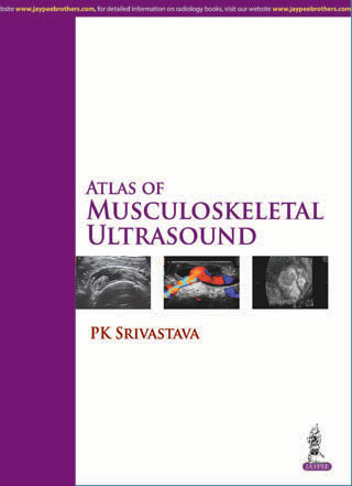 ATLAS OF MUSCULOSKELETAL ULTRASOUND 1/E, 2015, PK SRIVASTAVA