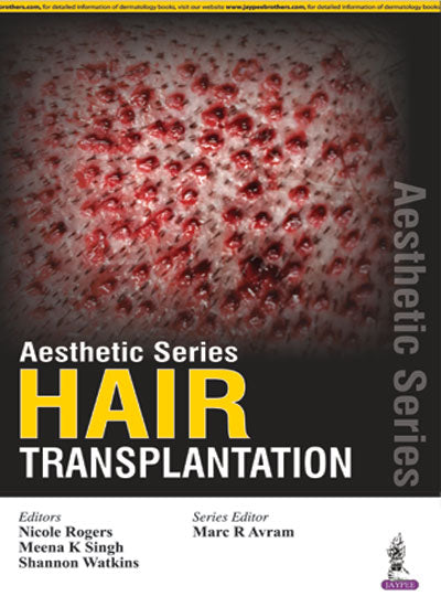 AESTHETIC SERIES:HAIR TRANSPLANTATION 1/E, 2016, NICOLE ROGERS