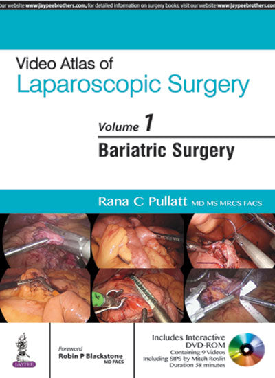 VIDEO ATLAS OF LAPAROSCOPIC SURGERY VOL.1 BARIATRIC SURGERY WITH DVD-ROM 1/E, 2016, RANA C PULLATT