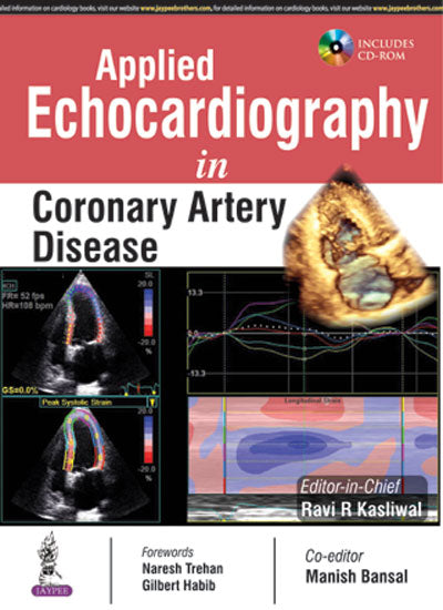 APPLIED ECHOCARDIOGRAPHY IN CORONARY ARTERY DISEASE INCLUDES CD-ROM 1/E, 2016, RAVI R KASLIWAL