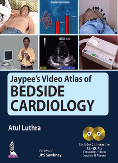 JAYPEE'S VIDEO ATLAS OF BEDSIDE CARDIOLOGY INCLUDES 2 INTERACTIVE CD-ROMS 1/E, 2016, ATUL LUTHRA