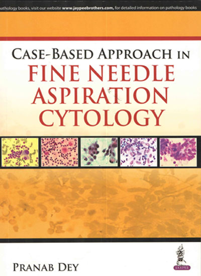 CASE-BASED APPROACH IN FINE NEEDLE ASPIRATION CYTOLOGY 1/E, 2016, PRANAB DEY