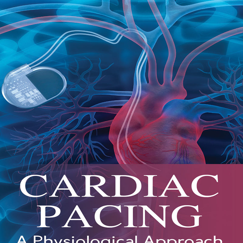 CARDIAC PACING A PHYSIOLOGICAL APPROACH 1/E R.P., 2025, ASIT DAS