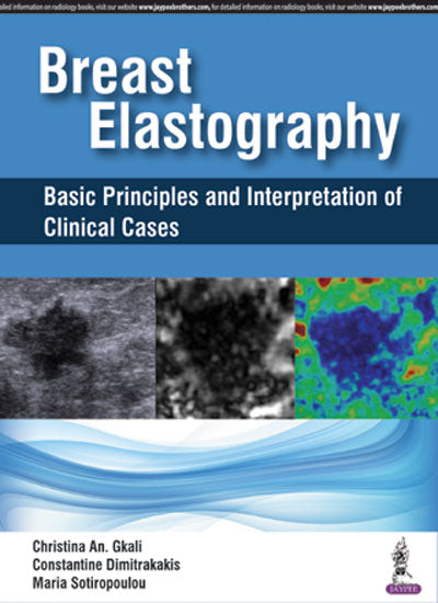 BREAST ELASTOGRAPHY BASIC PRINCIPLES AND INTERPRETATION OF CLINICAL CASES 1/E, 2018, CHRISTINA AN.GKALI