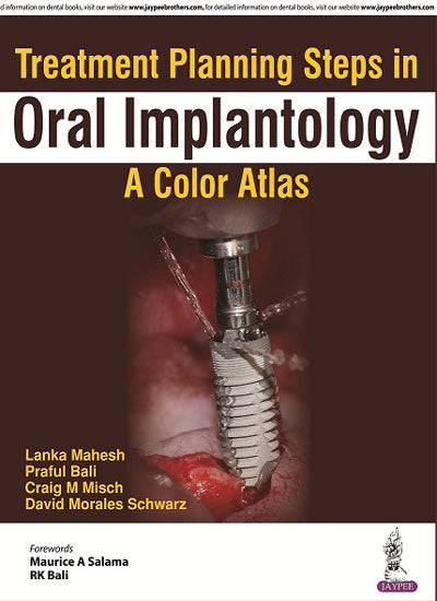 TREATMENT PLANNING STEPS IN ORAL IMPLANTOLOGY:A COLOR ATLAS 1/E, 2018, LANKA MAHESH