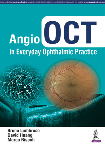 ANGIO OCT IN EVERYDAY OPHTHALMIC PRACTICE 1/E, 2017, BRUNO LUMBROSO