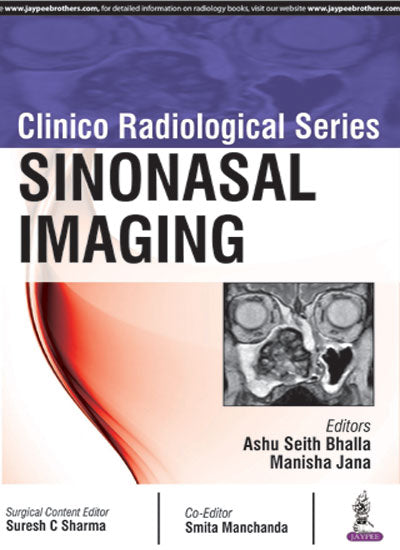 CLINICO RADIOLOICAL SERIES:SINONASAL IMAGING 1/E, 2018, ASHU SEITH BHALLA