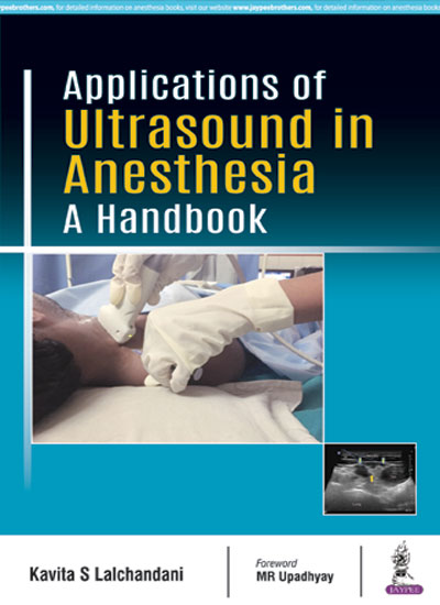 APPLICATIONS OF ULTRASOUND IN ANESTHESIA A HANDBOOK 1/E, 2018, KAVITA S LALCHANDANI