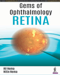 GEMS OF OPHTHALMOLOGY RETINA 1/E, 2018, HV NEMA