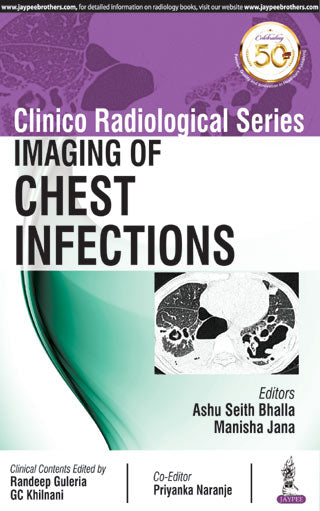 CLINICO RADIOLOGICAL SERIES IMAGING OF CHEST INFECTIONS 1/E, 2019, ASHU SEITH BHALLA