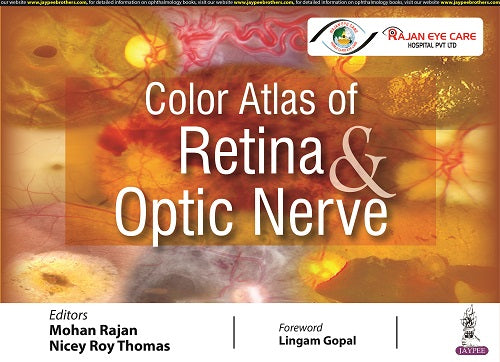 COLOR ATLAS OF RETINA & OPTIC NERVE 1/E,R.P., 2025, RAJAN MOHAN